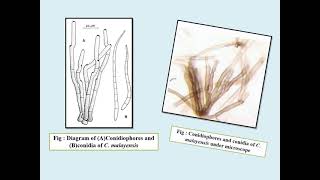 Cercospora leaf spot of okra prepared by Boyapati Ravi Teja Naidu and Rajat Kumar [upl. by Htebsle122]