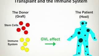 Managing Chronic GVHD 100 Days After Transplant and Beyond [upl. by Ydac846]