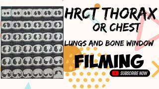 😮‍💨HOW TO DO HRCT THORAXCHEST FILMING PROCESS  LUNGS AND BONE WINDOW FILMING🎞 [upl. by Henke50]