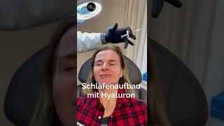 Schläfenaufbau mit Hyaluron by DoctorGroos 😍 [upl. by Chenay733]