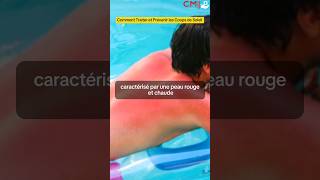 Soins et Cicatrisation des Coups de Soleil  Guide Complet par des Experts [upl. by Vivianna178]