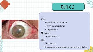 Xeroderma Pigmentosum [upl. by Nomma]