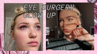 GLOW UP AFTER EYE SURGERY Alyssa McKay [upl. by Desberg397]