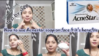 How to use Acnestar soap on faceAcnestar benefitsPimple amp acne treatmentAcneprone skin skincare [upl. by Mathe]