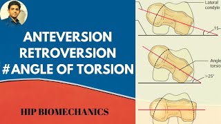 Anterversionamp Retroversion Angle of torsionhip biomechanics [upl. by Jacinda]