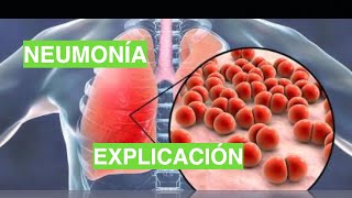 ¿Cómo se produce la Neumonía Fisiopatología de la Neumonía [upl. by Flss537]