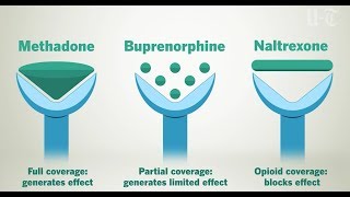 How Opioid Treatment Medications Work On Your Brain  San Diego UnionTribune [upl. by Yerdua]