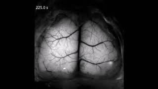 Cortexwide neural interfacing via transparent polymer skulls [upl. by Mareld344]