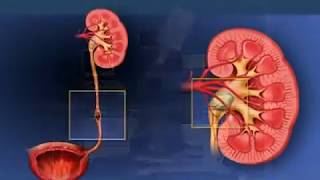 Litotripsia Extracorpórea por Ondas de Choque Urología Peruana Dr Luis Susaníbar [upl. by Anatole]