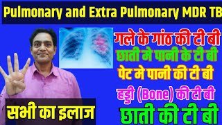 छाती के टी बीगले की टी बीबोन टी बीPulmonary tb and Extra Pulmonary Tb treatment mdrtbtreatment [upl. by Zobias481]