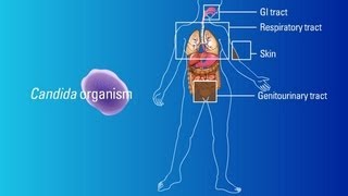 Sources of Candida Organisms [upl. by Aissela114]