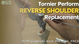 Tornier Perform Reverse Shoulder Replacement  Saw Bone  Surgical Technique  Dr Priyadarshi Amit [upl. by Colvin]