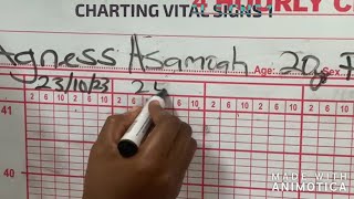 charting vital signs 1  intro nursingart247 [upl. by Hsejar]