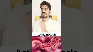 Actinomycosis In Hindi and Function anatomy quiz [upl. by Onra]