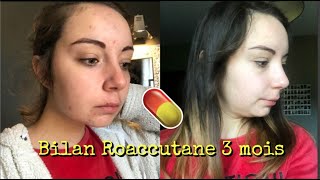 Bilan après 3 mois avec ROACCUTANE Produits effets secondaires [upl. by Ameh]