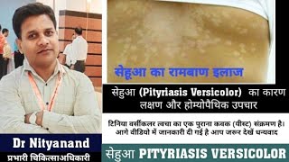 सेहुआ Pityriasis VersicolorTinea Versicolor का कारण लक्षण और होम्योपैथिक उपचार [upl. by Assener62]