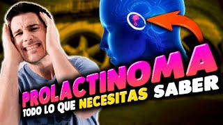 PROLACTINOMA👨🏽‍⚕️Qué Es✍🏼Síntomas💊Tratamiento😬Explicado FÁCIL [upl. by Eeliab]