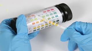 Urine Dipstick assay for proteinuria  Important Points for MDDM residents [upl. by Yrtnahc]