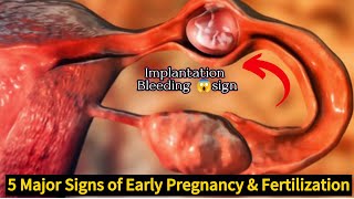 5 Major Signs of Fertilized EggSign of Early PregnancyImplantation Bleeding [upl. by Yrreg]