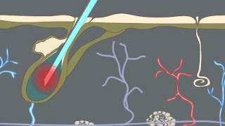 How Electrolysis Works Animation [upl. by Schluter]