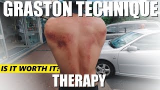 Graston Technique Muscle Scraping  MY EXPERIENCE [upl. by Ernest509]