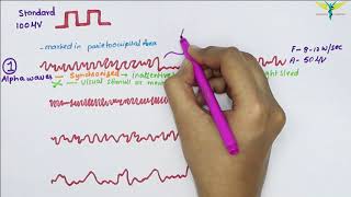 Electroencephalogram EEG  Waves  Physiology [upl. by Ajad]