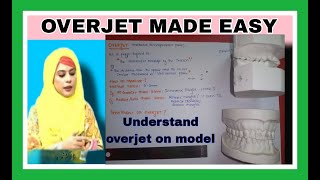 What is overjetincrease overjet and reverseanterior crossbite in orthodontics Chap1 proffit [upl. by Sessilu]