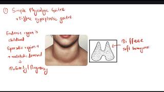 Simple Goitre  Thyroid [upl. by Marjy]