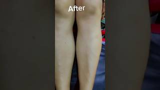 How to Wax Remove at Home Legswaxing  hair  short removehomemade 🦶🦶🦶🤗🤗🤗🤗🤗 [upl. by Mariandi506]