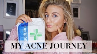 MY ACNE JOURNEY  ADVICE THAT CHANGED MY LIFE  WHAT DID amp DIDNT WORK [upl. by Storfer]