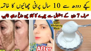 Diy Skin Whitening  Remove Dark Spots Pigmentation  Magical Results  Home Remedies [upl. by Aikan]