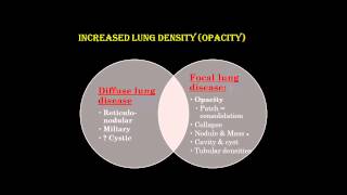 Chest X ray interpretation Part1DR AMR SAADAWY [upl. by Asilef331]