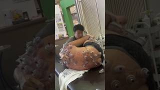 CRAZIEST Bodywork I’ve Ever Seen 😳 Reaction To Cupping Therapy massage mobility cupping [upl. by Nywra158]