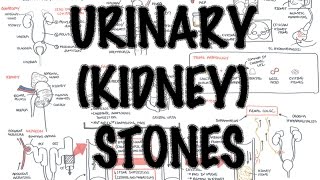 UrinaryKidney Stones  Overview signs and symptoms risk factors pathophysiology treatment [upl. by Koball]