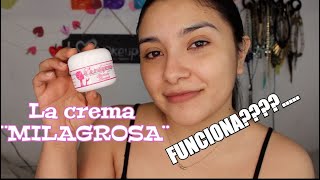 La crema MILAGROSA funciona  Mi experiencia [upl. by Seel]