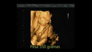 MEDIPEDIA Feto com 5 meses 3D4D em tempo real Ultrassonografia [upl. by Bryce]