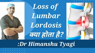 Loss of Lumbar lordosis क्या होता है [upl. by Winson672]