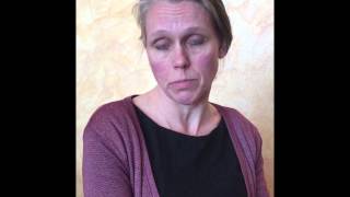 Jill Prawer Lipoprotein Lipase Deficiency UK European Patients Academy [upl. by Wolf]