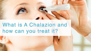 What is A Chalazion and how can you treat it [upl. by Nnelg]