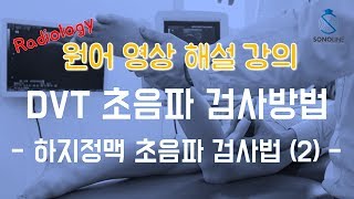 심부정맥혈전 초음파 검사  Lesson 5 [upl. by Metah]