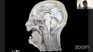 Microsurgical Anatomy of the Subarachnoid Cisterns [upl. by Ahsan]