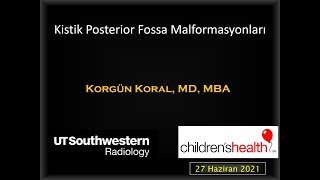 Kistik Posterior Fossa Malformasyonları [upl. by Kenwood986]