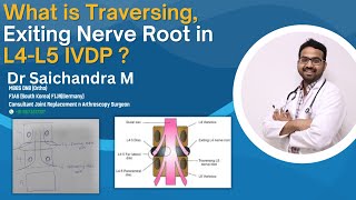 What is Traversing Exiting Nerve Root in L4L5 IVDP  Dr Sai Chandra MBBS DNB Ortho [upl. by Gamin810]