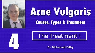 Acne Vulgaris Course  Part  4 [upl. by Aniraad934]