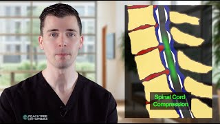 Cervical Myelopathy – Dr George Fryhofer [upl. by Ferrick]