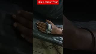 Brain hemorrhage physiotherapy trending shortvideodrabhaysinghpt [upl. by Tia]