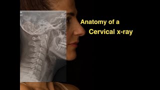 Anatomy of a Cervical xray [upl. by Aisa]