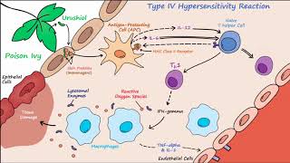 Type IV Hypersensitivity Described Concisely [upl. by Valida315]