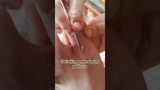 satisfying and relaxing pedicure pedicure relaxing satisfying nailcare dryskin [upl. by Huey259]