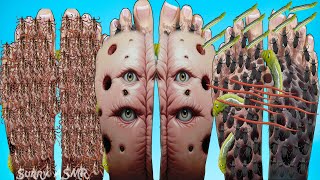 ASMR Removal Dog Tick Infested Feet🦶  Severely Injured Treatment Animation [upl. by Turner]